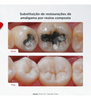 Resina Foto Esmalte E Dentina Llis Fgm - Sua Cor Cor Da3.5